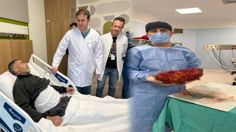 tip-dunyasini-sasirtan-operasyon-karnindan-8-kiloluk-bobrek-cikarildi-VLEaSgIe