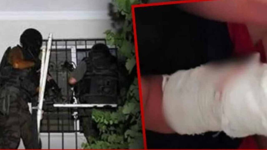 Bingöl’de Yanlış Eve Baskın: Alçılı Koluyla Çocuğa Ters Kelepçe Takıldı